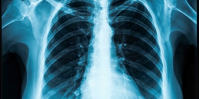 Ab dem 31.12.2018 wird das neue Strahlenschutzgesetz in Kraft treten. In diesem Artikel erfahren Sie welche Neuerungen sich durch das neue Gesetz ergeben und welchen Einfluß das auf die Radiologie hat.