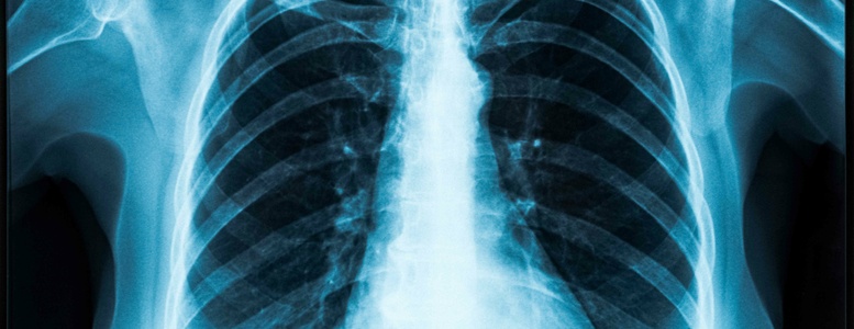 Ab dem 31.12.2018 wird das neue Strahlenschutzgesetz in Kraft treten. In diesem Artikel erfahren Sie welche Neuerungen sich durch das neue Gesetz ergeben und welchen Einfluß das auf die Radiologie hat.